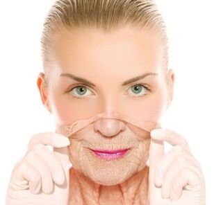 Laser renovation