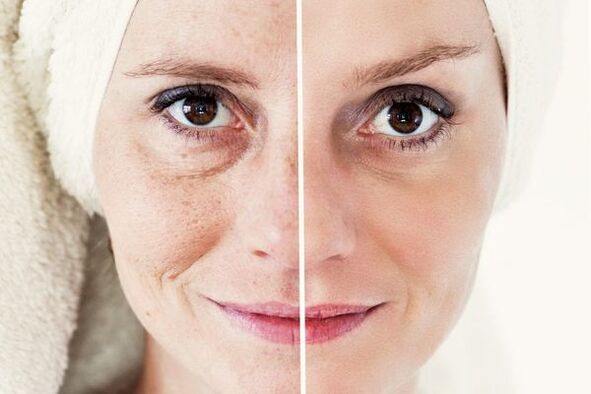 before and after
