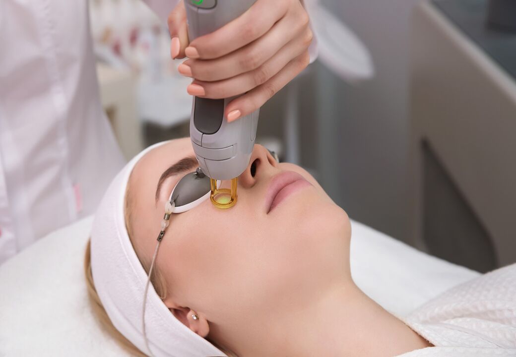 Laser renovation