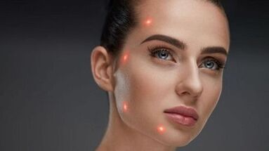 What is partial skin rejuvenation