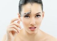 Girl after fractional laser facial rejuvenation