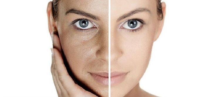 before and after facial skin rejuvenation