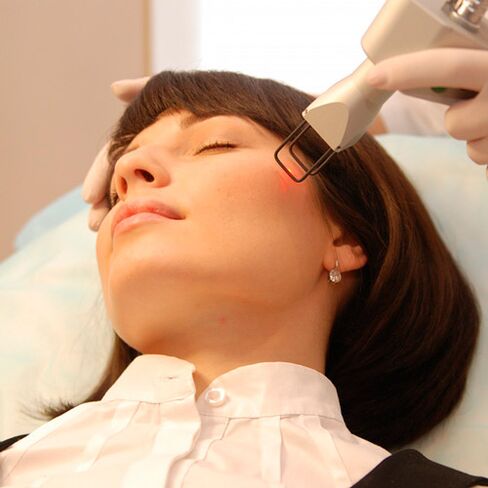 Facial skin rejuvenation with fractional laser