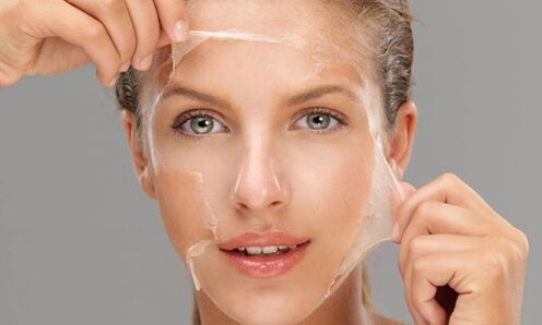 Deep peeling increases the regeneration processes in the skin, renewing it